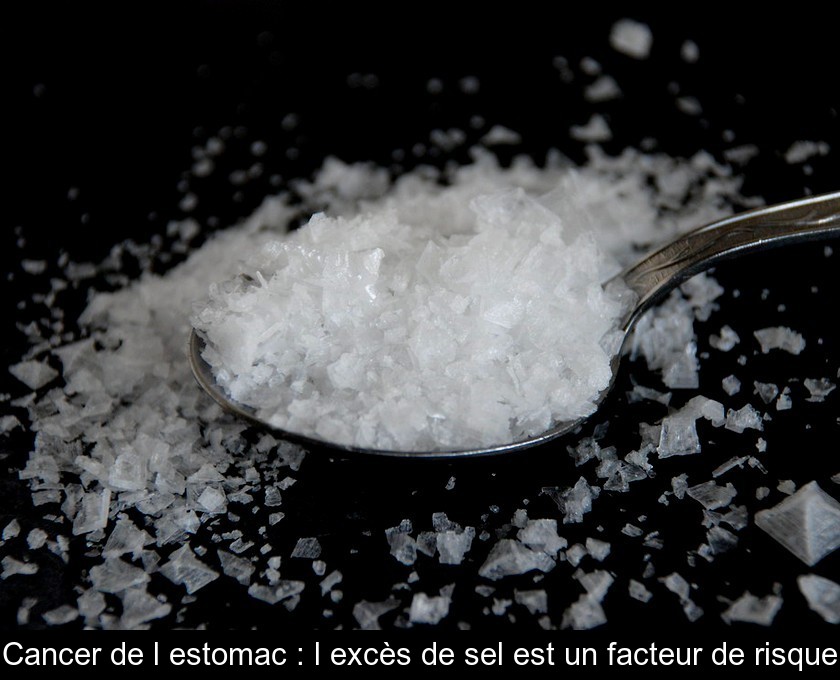 Cancer de l'estomac : l'excès de sel est un facteur de risque